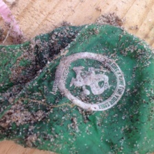 Ardalan Pediatric Dentistry Ardalan Pediatric Dentistry - Balloon Debris